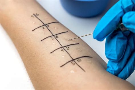 scratch test on skin|understanding skin scratch tests.